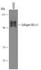 Collagen Type XIII Alpha 1 Chain antibody, AF6346, R&D Systems, Western Blot image 