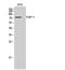 PARP2 antibody, STJ94959, St John