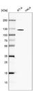 TBC1 Domain Family Member 2B antibody, NBP2-30533, Novus Biologicals, Western Blot image 