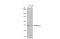 Methyltransferase Like 3 antibody, GTX105037, GeneTex, Western Blot image 