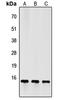 Follicle Stimulating Hormone Subunit Beta antibody, abx121607, Abbexa, Western Blot image 