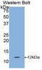 Interleukin 1 Receptor Type 1 antibody, LS-C303970, Lifespan Biosciences, Western Blot image 