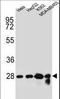 Choline Phosphotransferase 1 antibody, LS-C168747, Lifespan Biosciences, Western Blot image 
