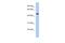 Spermatogenesis Associated 6 Like antibody, A18033, Boster Biological Technology, Western Blot image 