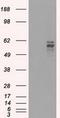 Fyn Related Src Family Tyrosine Kinase antibody, GTX84481, GeneTex, Western Blot image 