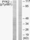 Protein Tyrosine Kinase 2 Beta antibody, LS-C199509, Lifespan Biosciences, Western Blot image 