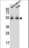 Prolylcarboxypeptidase antibody, LS-C162119, Lifespan Biosciences, Western Blot image 