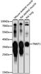 Troponin T3, Fast Skeletal Type antibody, LS-C750293, Lifespan Biosciences, Western Blot image 