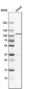 N(Alpha)-Acetyltransferase 15, NatA Auxiliary Subunit antibody, PA5-54833, Invitrogen Antibodies, Western Blot image 