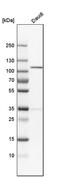 N-alpha-acetyltransferase 15, NatA auxiliary subunit antibody, PA5-54833, Invitrogen Antibodies, Western Blot image 