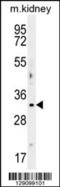 Nucleic Acid Binding Protein 2 antibody, MBS9206645, MyBioSource, Western Blot image 