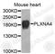 Plexin A4 antibody, A9990, ABclonal Technology, Western Blot image 