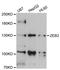 Zinc Finger E-Box Binding Homeobox 2 antibody, STJ29919, St John
