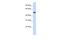 RasGEF Domain Family Member 1A antibody, A14628, Boster Biological Technology, Western Blot image 