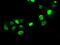 SATB Homeobox 1 antibody, GTX83682, GeneTex, Immunofluorescence image 