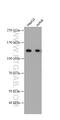 Interferon Induced With Helicase C Domain 1 antibody, 66770-1-Ig, Proteintech Group, Western Blot image 