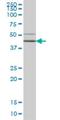 HORMA Domain Containing 1 antibody, H00084072-M01, Novus Biologicals, Western Blot image 