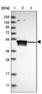 TRNA Splicing Endonuclease Subunit 2 antibody, PA5-55511, Invitrogen Antibodies, Western Blot image 