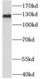 PAB-dependent poly(A)-specific ribonuclease subunit 2 antibody, FNab06131, FineTest, Western Blot image 