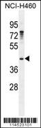 Growth Arrest Specific 1 antibody, 56-087, ProSci, Western Blot image 