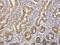 Rho Associated Coiled-Coil Containing Protein Kinase 2 antibody, H00009475-M02, Novus Biologicals, Immunohistochemistry paraffin image 