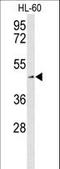 Solute Carrier Family 1 Member 5 antibody, LS-C161152, Lifespan Biosciences, Western Blot image 