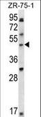 LIM Domain Binding 1 antibody, LS-C165726, Lifespan Biosciences, Western Blot image 