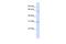 Transmembrane Protein 106C antibody, A15864, Boster Biological Technology, Western Blot image 