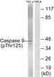 Caspase 9 antibody, 79-781, ProSci, Western Blot image 