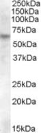 Retinoid Isomerohydrolase RPE65 antibody, LS-C55421, Lifespan Biosciences, Western Blot image 