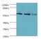 Regulator Of Microtubule Dynamics 3 antibody, LS-C378382, Lifespan Biosciences, Western Blot image 