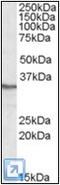Serine/threonine-protein phosphatase 4 catalytic subunit antibody, AP22586PU-N, Origene, Western Blot image 