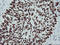 p53 antibody, LS-C172779, Lifespan Biosciences, Immunohistochemistry paraffin image 