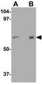 Interleukin 22 Receptor Subunit Alpha 1 antibody, GTX16978, GeneTex, Western Blot image 