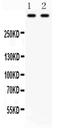 Plectin antibody, PA5-79829, Invitrogen Antibodies, Western Blot image 