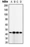 Tumor Suppressor Candidate 3 antibody, MBS821000, MyBioSource, Western Blot image 