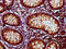 SEC23 Homolog B, Coat Complex II Component antibody, LS-C681272, Lifespan Biosciences, Immunohistochemistry paraffin image 