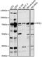 Transketolase Like 1 antibody, 15-996, ProSci, Western Blot image 