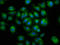 Lectin, Mannose Binding 1 antibody, LS-C674974, Lifespan Biosciences, Immunofluorescence image 