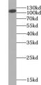 Ubiquitin Specific Peptidase 33 antibody, FNab09325, FineTest, Western Blot image 