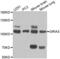 Glutamate Ionotropic Receptor AMPA Type Subunit 3 antibody, abx001073, Abbexa, Western Blot image 