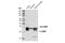 Catechol-O-Methyltransferase antibody, 14368S, Cell Signaling Technology, Western Blot image 