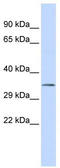 Upstream Transcription Factor 1 antibody, TA335665, Origene, Western Blot image 