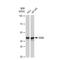 Damage Specific DNA Binding Protein 2 antibody, GTX03189, GeneTex, Western Blot image 