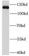 NIMA Related Kinase 9 antibody, FNab05654, FineTest, Western Blot image 