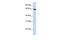 Solute Carrier Family 6 Member 2 antibody, GTX47102, GeneTex, Western Blot image 