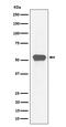 Myocyte Enhancer Factor 2A antibody, M01398-1, Boster Biological Technology, Western Blot image 