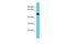 Chromosome 5 Open Reading Frame 22 antibody, A17239, Boster Biological Technology, Western Blot image 