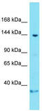 BRD4 Interacting Chromatin Remodeling Complex Associated Protein antibody, TA331255, Origene, Western Blot image 