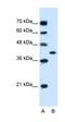Glutamic-Oxaloacetic Transaminase 2 antibody, orb330307, Biorbyt, Western Blot image 